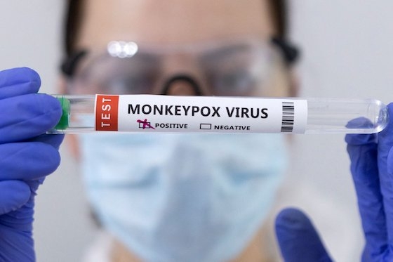 Συναγερμός στον ΕΟΔΥ για την ευλογιά των πιθήκων 