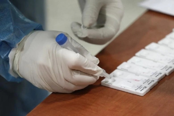 «Stop» στα rapid tests από τα φαρμακεία ζητούν οι Iατρικοί Σύλλογοι της ΑΜΘ